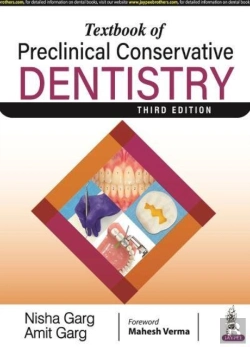 Bertrand.pt - Textbook Of Preclinical Conservative Dentistry