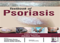 Textbook Of Psoriasis