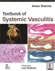 Textbook Of Systemic Vasculitis