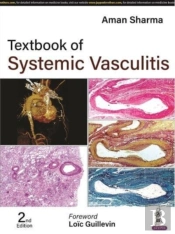 Textbook Of Systemic Vasculitis