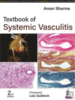 Bertrand.pt - Textbook Of Systemic Vasculitis