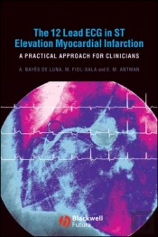 The 12 Lead Ecg In St Elevation Myocardial Infarction