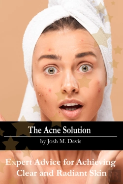 Bertrand.pt - The Acne Solution