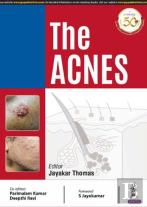 The Acnes