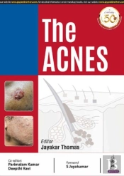 The Acnes