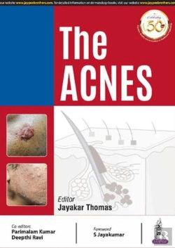 Bertrand.pt - The Acnes