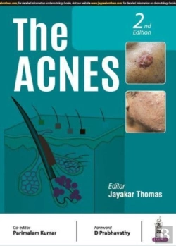Bertrand.pt - The Acnes
