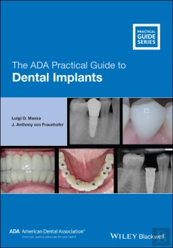 Bertrand.pt - The Ada Practical Guide To Dental Implants