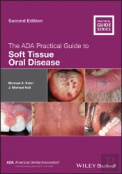 The Ada Practical Guide To Soft Tissue Oral Disease