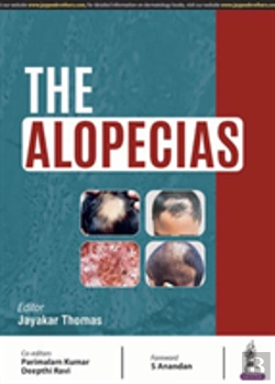 Bertrand.pt - The Alopecias