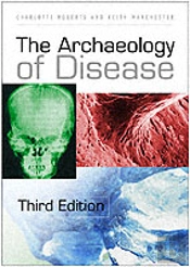 The Archaeology Of Disease