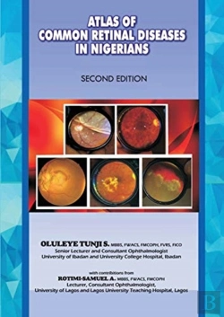 Bertrand.pt - The Atlas Of Retinal Diseases In Nigerians