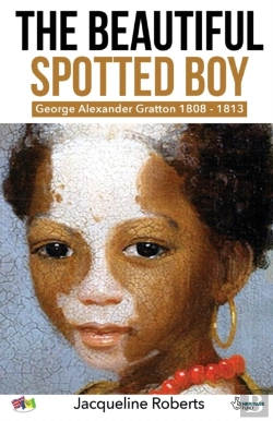 Bertrand.pt - The Beautiful Spotted Boy