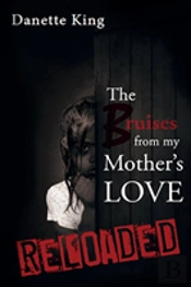 The Bruises From My Mother'S Love