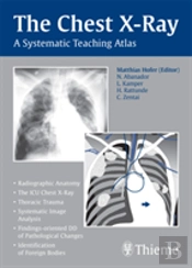 The Chest X-Ray