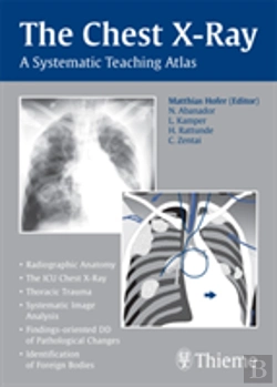 Bertrand.pt - The Chest X-Ray