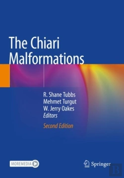 Bertrand.pt - The Chiari Malformations