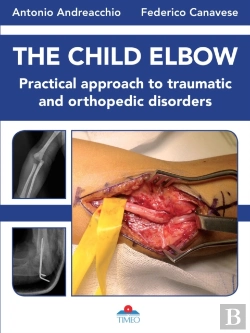 Bertrand.pt - The Child Elbow
