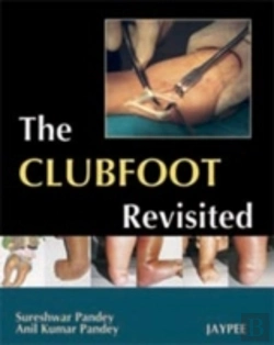 Bertrand.pt - The Club Foot Revisited