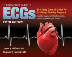 The Complete Guide To Ecgs: A Comprehensive Study Guide To Improve Ecg Interpretation Skills