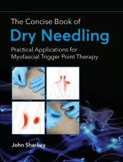 The Concise Book Of Dry Needling