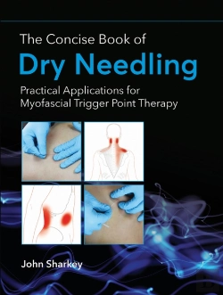 Bertrand.pt - The Concise Book Of Dry Needling