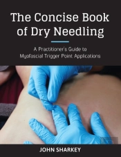 The Concise Book Of Dry Needling