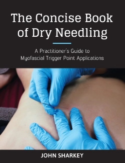 Bertrand.pt - The Concise Book Of Dry Needling