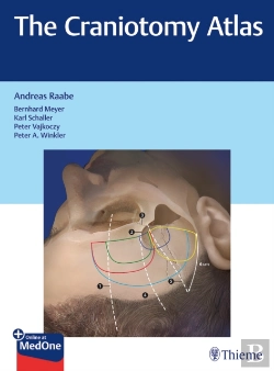 Bertrand.pt - The Craniotomy Atlas