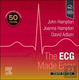 The Ecg Made Easy