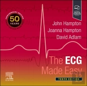 The Ecg Made Easy