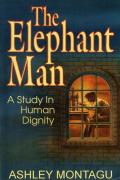 The Elephant Man