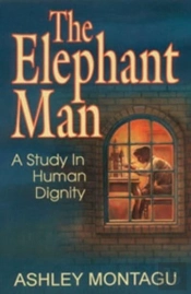 The Elephant Man