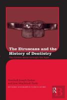 The Etruscans And The History Of Dentistry