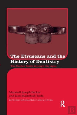 Bertrand.pt - The Etruscans And The History Of Dentistry