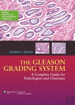 Bertrand.pt - The Gleason Grading System