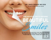 The Hidden Truth Behind Beautiful Smiles