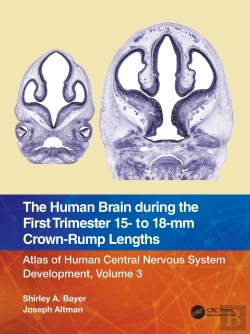 Bertrand.pt - The Human Brain During The First Trimester 15- To 18-Mm Crown-Rump Lengths