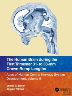 Bertrand.pt - The Human Brain During The First Trimester 31- To 33-Mm Crown-Rump Lengths
