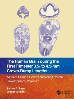 Bertrand.pt - The Human Brain During The First Trimester 3.5- To 4.5-Mm Crown-Rump Lengths