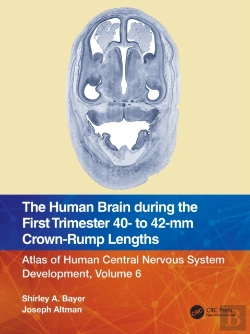 Bertrand.pt - The Human Brain During The First Trimester 40- To 42-Mm Crown-Rump Lengths