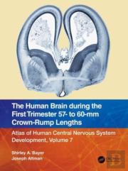 The Human Brain During The First Trimester 57- To 60-Mm Crown-Rump Lengths