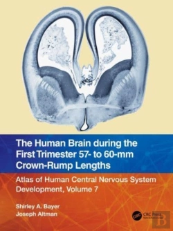 Bertrand.pt - The Human Brain During The First Trimester 57- To 60-Mm Crown-Rump Lengths