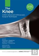 The Knee