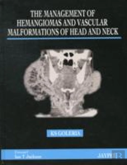 Bertrand.pt - The Management Of Haemangiomas And Vascular Malformations Of Head And Neck