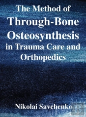 The Method Of Through-Bone Osteosynthesi