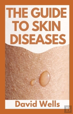 Bertrand.pt - The New Guide To Skin Diseases