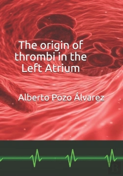 Bertrand.pt - The Origin Of Thrombi In The Left Atrium
