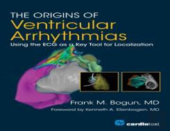 The Origins Of Ventricular Arrhythmias