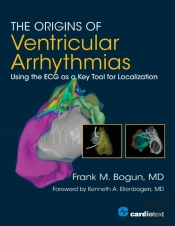 The Origins Of Ventricular Arrhythmias